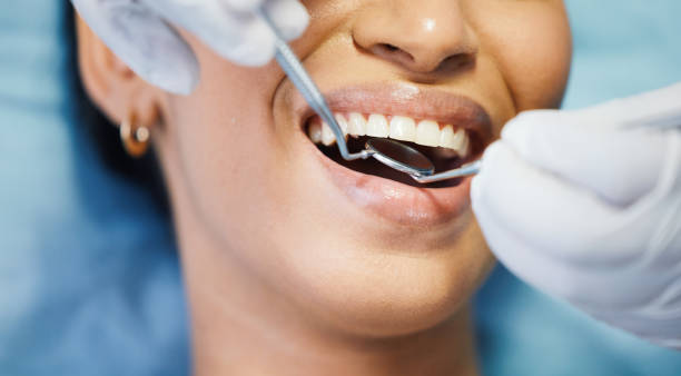 Best Emergency Wisdom Tooth Extraction in Panhandle, TX